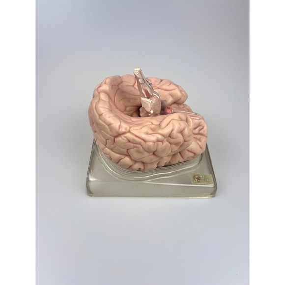 Vintage Somso Germany Anatomical Teaching Model | Human Brain | 6 Parts | Oddity - Picture 5 of 9